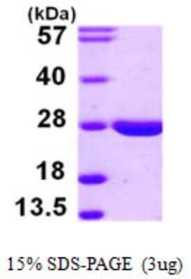 SDS-PAGE: Recombinant Human LYPLA2 His Protein [NBP1-51003]