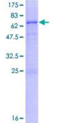 SDS-PAGE: Recombinant Human LYPLA3 GST (N-Term) Protein [H00023659-P01]