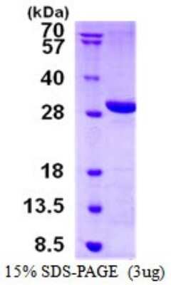 SDS-PAGE: Recombinant Human LYPLAL1 His Protein [NBP1-98886]