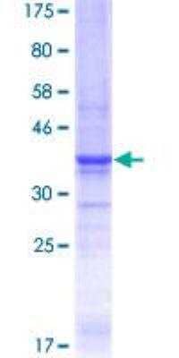 SDS-PAGE: Recombinant Human Laminin alpha 5 GST (N-Term) Protein [H00003911-Q01]