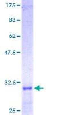 SDS-PAGE: Recombinant Human Laminin gamma 1 GST (N-Term) Protein [H00003915-P01]