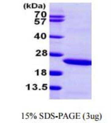 SDS-PAGE: Recombinant Human Lipocalin-2/NGAL His Protein [NBP1-50987]