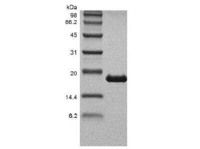 SDS-PAGE: Recombinant Human Lymphotoxin-alpha/TNF-beta Protein [NBP2-61307]