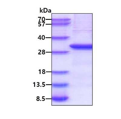 SDS-PAGE: Recombinant Human Lymphotoxin beta R/TNFRSF3 His Protein [NBP2-51906]