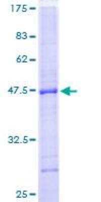 SDS-PAGE: Recombinant Human Lyp/PTPN22 GST (N-Term) Protein [H00026191-P01]