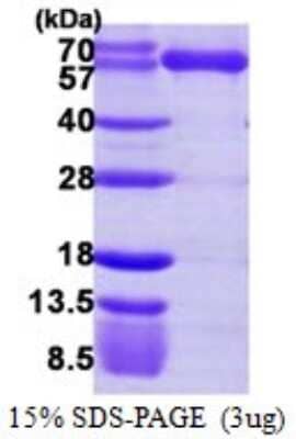 SDS-PAGE: Recombinant Human Lysyl tRNA synthetase His Protein [NBP1-72410]