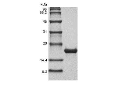 SDS-PAGE: Recombinant Human M-CSF Protein [NBP2-34975]