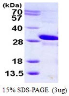 SDS-PAGE: Recombinant Human M-Ras/R-Ras3 His Protein [NBP1-78834]