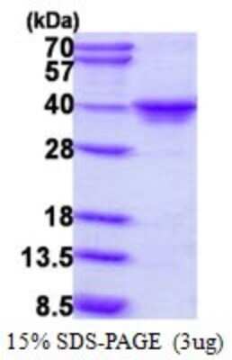 SDS-PAGE: Recombinant Human MAF1 His Protein [NBP1-72440]