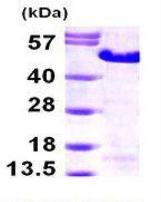 SDS-PAGE: Recombinant Human MAGEA3 His Protein [NBP1-49445]