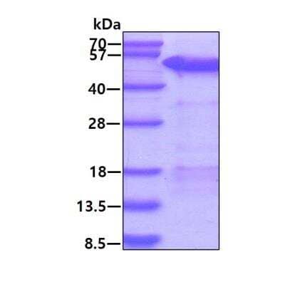 SDS-PAGE: Recombinant Human MAGEA4 His Protein [NBP1-45259]