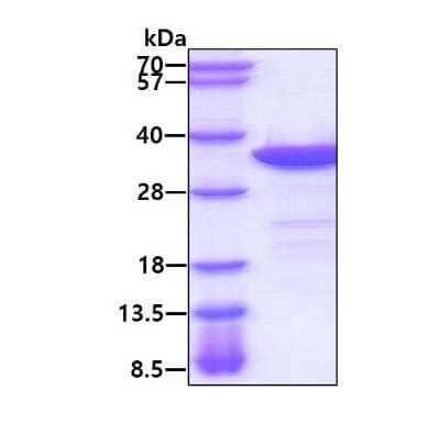 SDS-PAGE: Recombinant Human MAPRE1 His Protein [NBP1-50935]