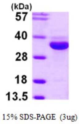 SDS-PAGE: Recombinant Human MASA His Protein [NBP1-51004]