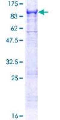 SDS-PAGE: Recombinant Human MASP2 GST (N-Term) Protein [H00010747-P01]