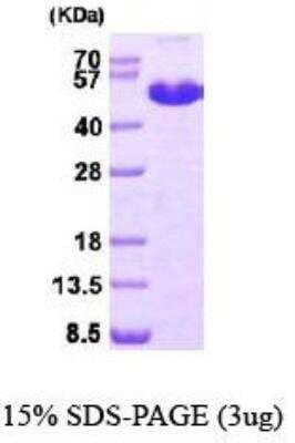 SDS-PAGE: Recombinant Human MAT1A His Protein [NBP1-40408]