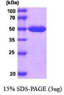 SDS-PAGE: Recombinant Human MAT2A His Protein [NBC1-18515]