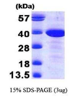 SDS-PAGE: Recombinant Human MAT2B Protein [NBP1-30288]