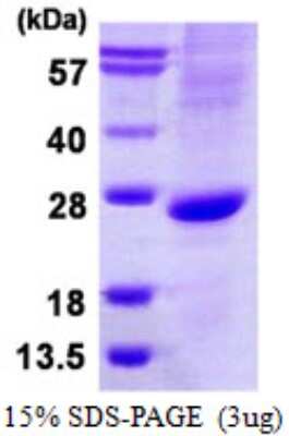 SDS-PAGE: Recombinant Human MATH1 Protein [NBP1-99040]