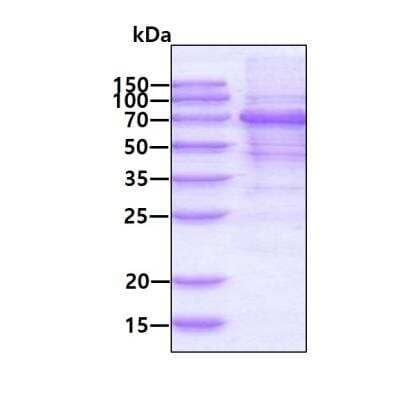 SDS-PAGE: Recombinant Human MAVS His Protein [NBP2-23238]