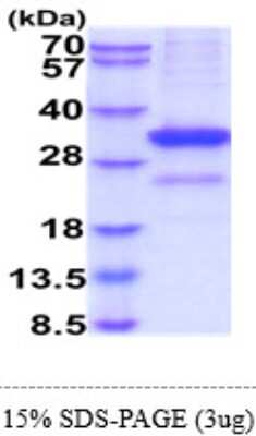 SDS-PAGE: Recombinant Human MBL-2 His Protein [NBP2-61994]