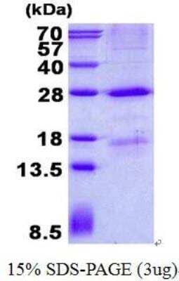 SDS-PAGE: Recombinant Human MBL His Protein [NBP2-23215]