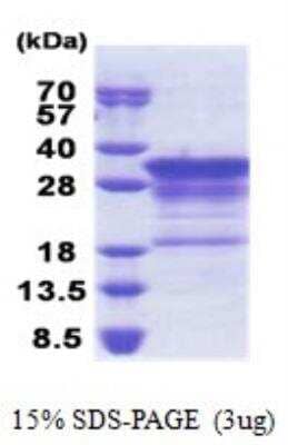 SDS-PAGE: Recombinant Human MBP His Protein [NBP2-23253]