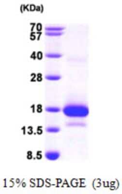 SDS-PAGE: Recombinant Human MCEE His Protein [NBP1-49440]