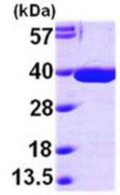 SDS-PAGE: Recombinant Human MDH2 His Protein [NBP1-48325]