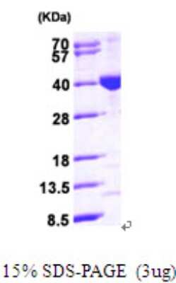 SDS-PAGE: Recombinant Human MECR His Protein [NBP2-59511]