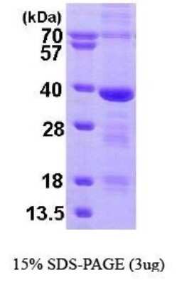 SDS-PAGE: Recombinant Human MED4 His Protein [NBP1-44479]