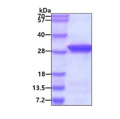 SDS-PAGE: Recombinant Human MESDC2 His Protein [NBP1-51009]