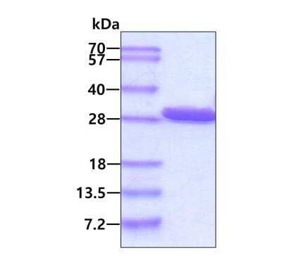 SDS-PAGE: Recombinant Human METTL21D His Protein [NBP2-51911]