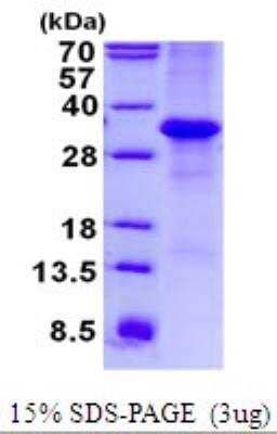 SDS-PAGE: Recombinant Human MFAP4 His Protein [NBP2-23235]