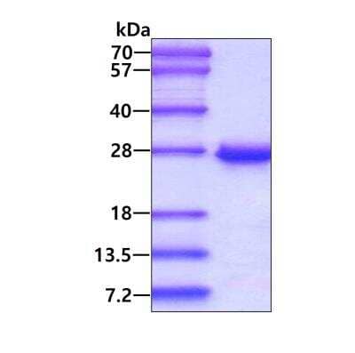 SDS-PAGE: Recombinant Human MGMT His Protein [NBC1-18534]