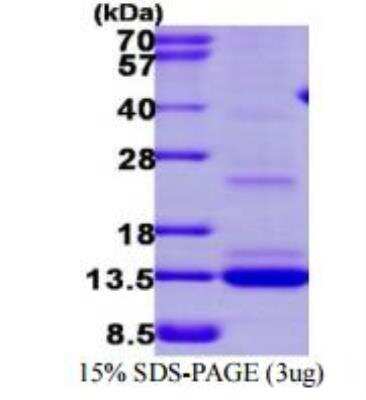 SDS-PAGE: Recombinant Human MGP His Protein [NBP1-72441]