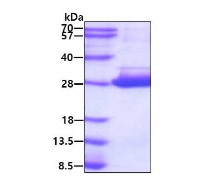 SDS-PAGE: Recombinant Human NRK1 His Protein [NBP1-98958]