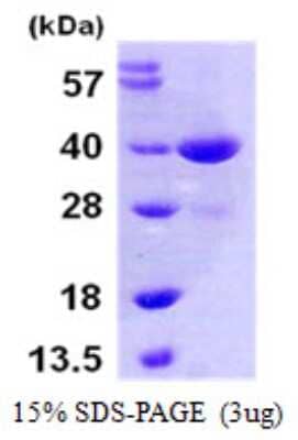 SDS-PAGE: Recombinant Human MKK3/MEK3 His Protein [NBP1-51069]