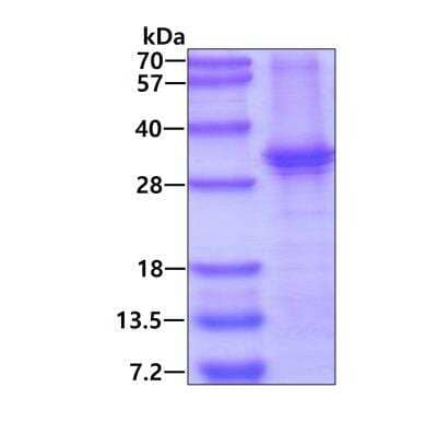 SDS-PAGE: Recombinant Human MKK6/MEK6 His Protein [NBP2-51949]