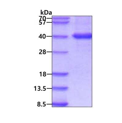 SDS-PAGE: Recombinant Human MKK6/MEK6 His Protein [NBP3-11963]