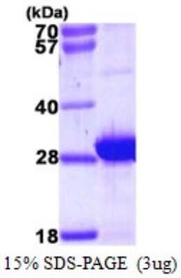 SDS-PAGE: Recombinant Human MLC1SA His Protein [NBP1-72448]