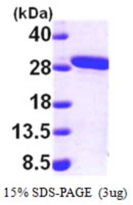 SDS-PAGE: Recombinant Human MMAB His Protein [NBP1-48323]