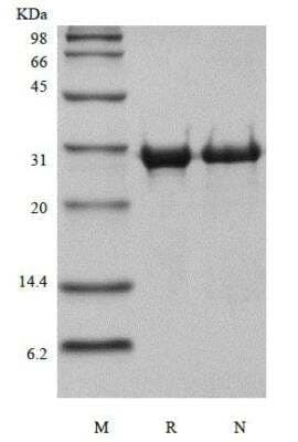 SDS-PAGE: Recombinant Human MMP-14/MT1-MMP Protein [NBP2-61379]