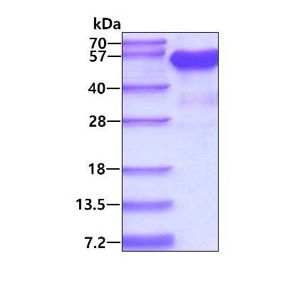 SDS-PAGE: Recombinant Human MNDA His Protein [NBP1-30314]