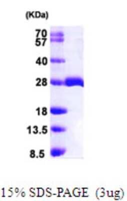 SDS-PAGE: Recombinant Human MOBKL1B His Protein [NBP1-50950]