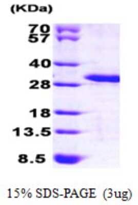 SDS-PAGE: Recombinant Human MOBKL3 His Protein [NBP1-50917]