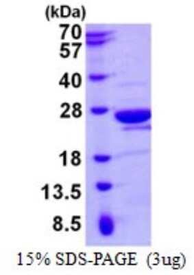 SDS-PAGE: Recombinant Human MOG1 His Protein [NBP1-98911]