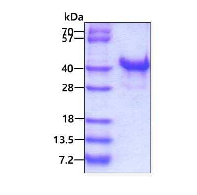 SDS-PAGE: Recombinant Human MPG His Protein [NBP1-72380]