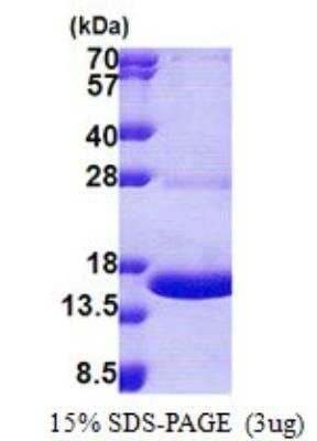 SDS-PAGE: Recombinant Human MPZL1 His Protein [NBP2-23254]