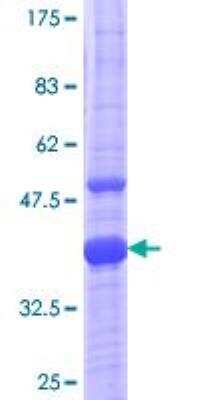 SDS-PAGE: Recombinant Human MR1 GST (N-Term) Protein [H00003140-Q01]