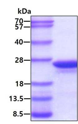 SDS-PAGE: Recombinant Human MRCL3 His Protein [NBP1-72407]